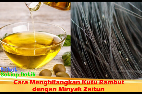 Cara Menghilangkan Kutu Rambut dengan Minyak Zaitun