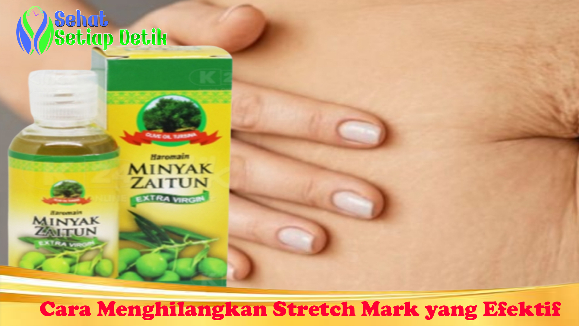 Cara Menghilangkan Stretch Mark yang Efektif