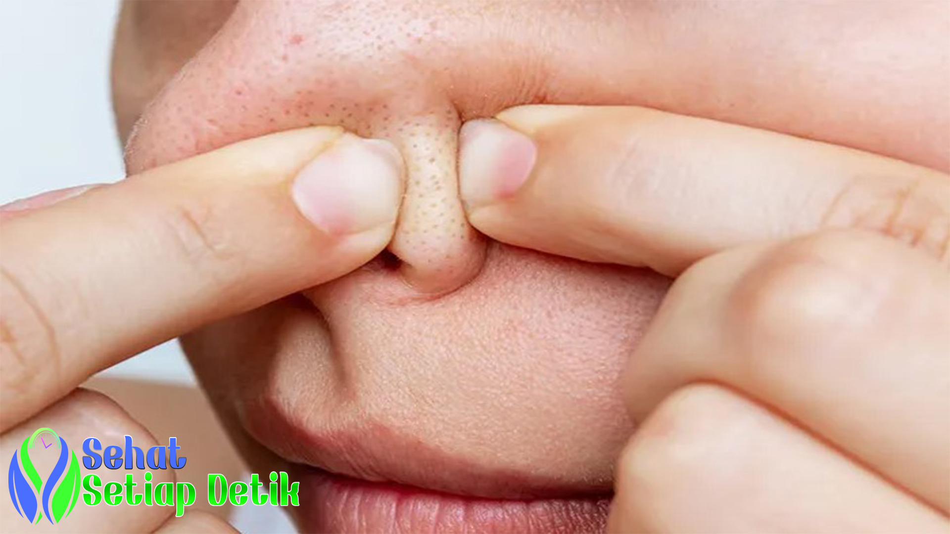 Cara Menghilangkan Komedo di Hidung dengan Aman